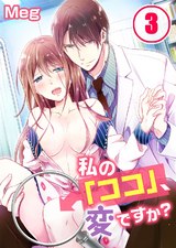 私の「ココ」、変ですか?(3) パッケージ画像表