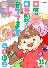 【分冊版】口唇口蓋裂ちゃん、育ててます 【第11話】 パッケージ画像