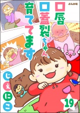 【分冊版】口唇口蓋裂ちゃん、育ててます 【第19話】 パッケージ画像