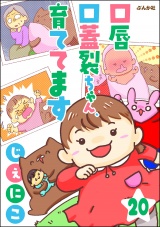 【分冊版】口唇口蓋裂ちゃん、育ててます 【第20話】 パッケージ画像